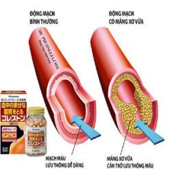 Viên uống giảm cholesterol Hisamitsu Nhật Bản